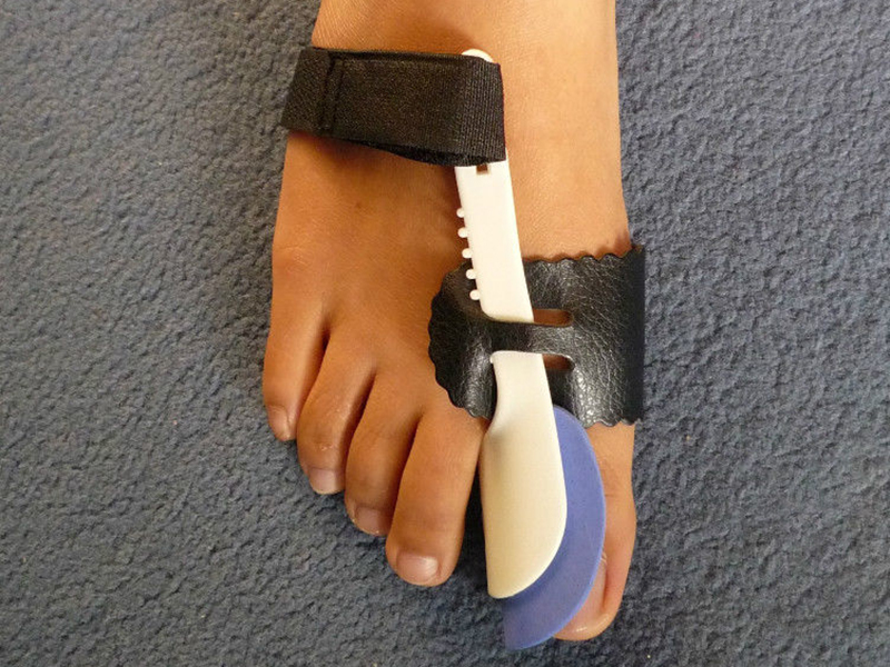 How to Make a Bunion Splint eBay