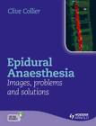 Epidural Anaesthesia Images, Problems and Solutions by Clive B. Collier (Hardback, 2011)
