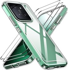 3in1 für Xiaomi 15 5G 2x Schutzglas 9H Panzerfolie Handy Hülle Case Hartglas