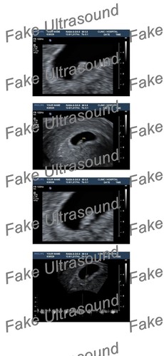 7 weeks Fake ultrasound baby customized Positive Pregnancy test gag prank