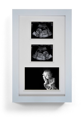 Nouveau-né Ultrasound scan naissance Triple Cadre Photo Grossesse Baby Shower cadeau