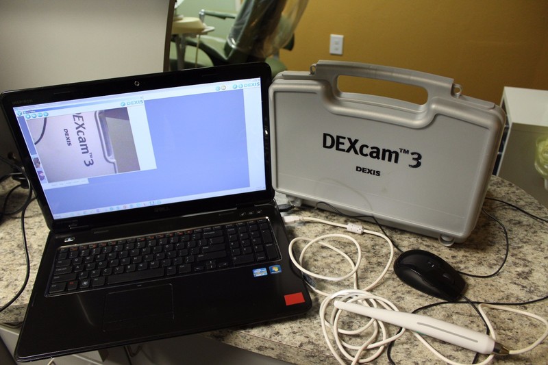 Dexcam 3 price