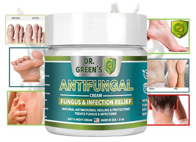 Antifungal Cream Ointment Athletes Foot Jock Itch Ringworm Tea Tree Infused Balm