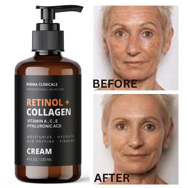 Retinol + Collagen, Hyaluronic Acid, Vitamin C Antiaging Wrinkle Serum Cream 4oz