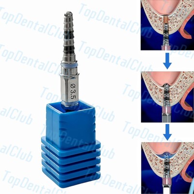5Holes Dental Water Rising Drill Hydraulic Membrane Hiossen Lifter Sinus 3.0/3.5