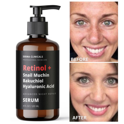 Retinol + Bakuchiol, Snail Muchin, Hyaluronic Acid, Anti aging Wrinkle SERUM 4oz