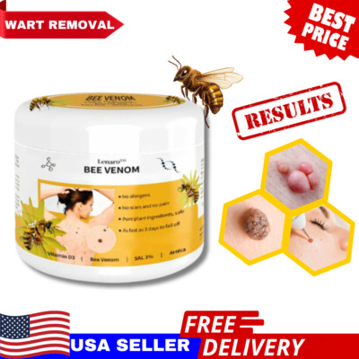 Bee Venom Skin Tag Removal Treatment Cream Body Care Mole Corn Wart Remover