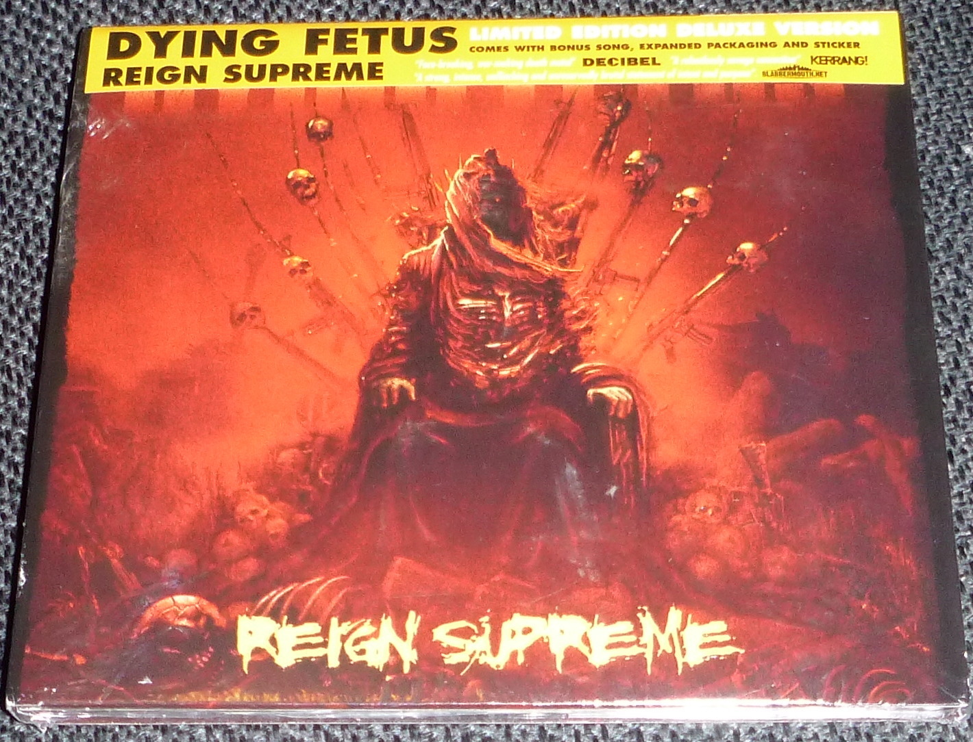 ブルデス Dying Fetus アルバムセット ブルデス Dying Fetus アルバムセット Amazon.co.jp: Stop at