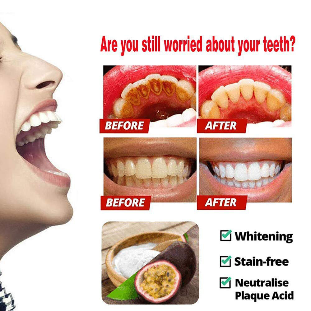 Blueberry Teeth Whitening Toothpaste Intensive Stain Removal Fight Bleeding Gums eBay