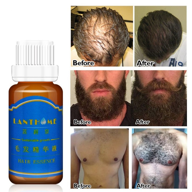 Beards Eyelash Hair Growth Essence Eyebrow Mustache Growth Anti