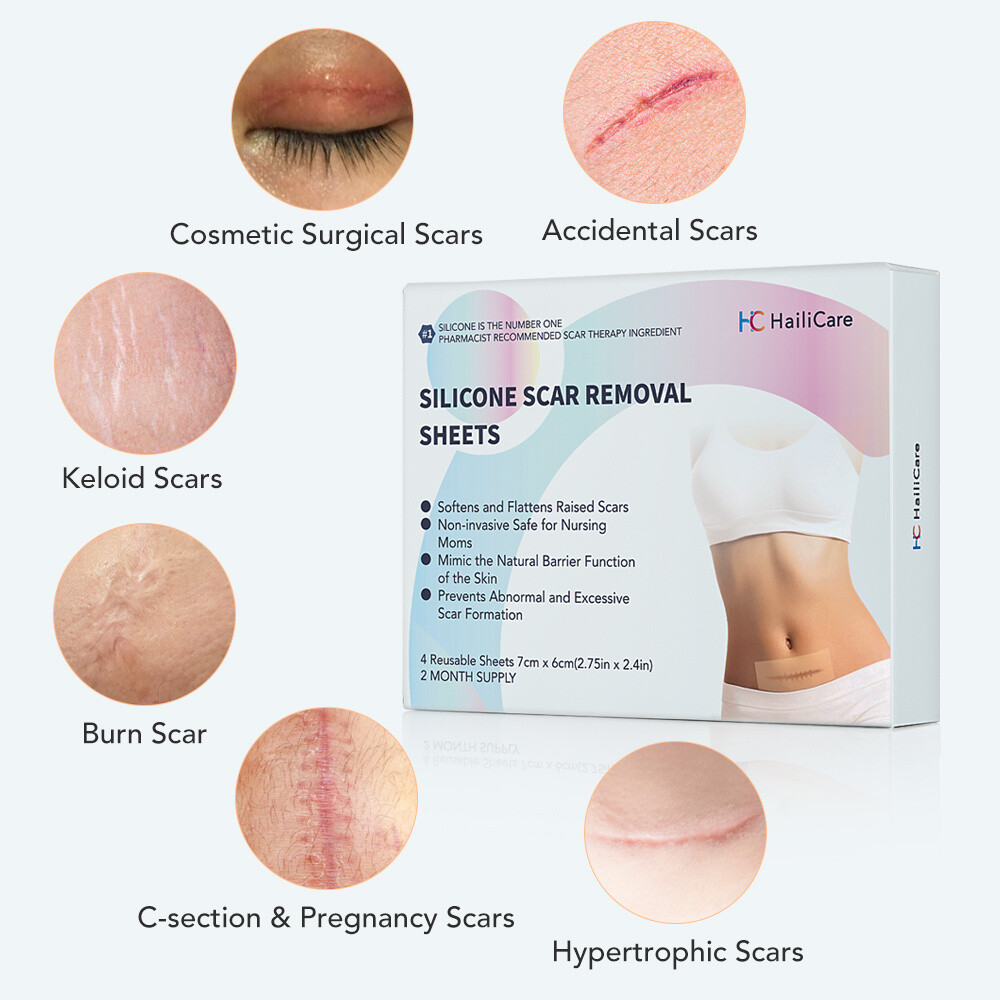 4 Sheets Puriderma Medical Silicone Scar Removal Sheets for Keloid C