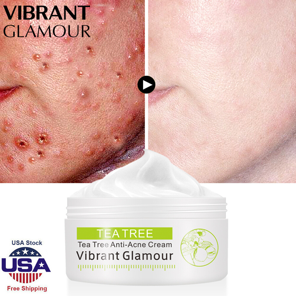 tea tree cream for spots