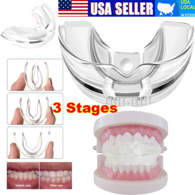 3 Stage Straighten Tool Dental Orthodontic Teeth Corrector Braces Tooth Retainer