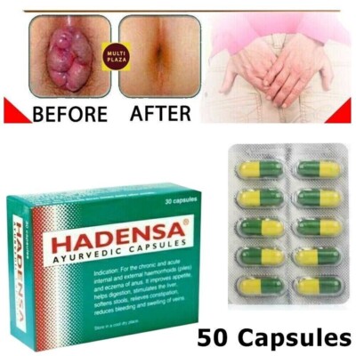 Hadensa 50 Pills Stop Permanent Piles Pain Itching Swelling Hemorrhoids Relives