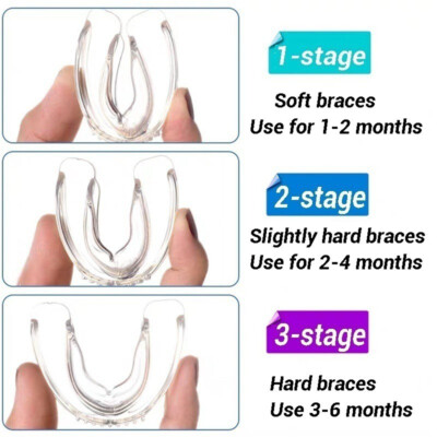 3 Stages Dental Orthodontic Teeth Corrector Braces For Adults Tooth Retainer US