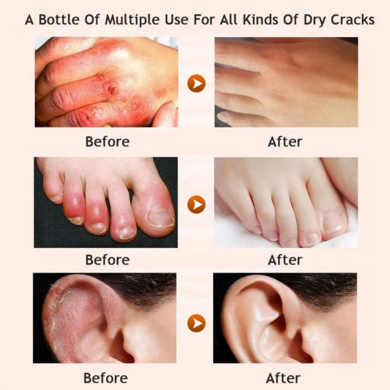Horse Oil Foot Cream Anti-Chapping Skin Repairing Moisturizer for Rough Dry and