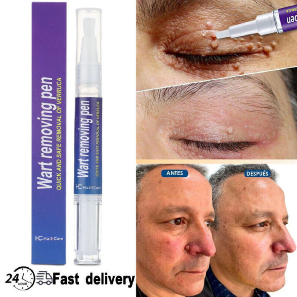2PACK 12 Hours Wart Remover Pen Skin Tag Mole Remover Eliminate Foot Corn Warts