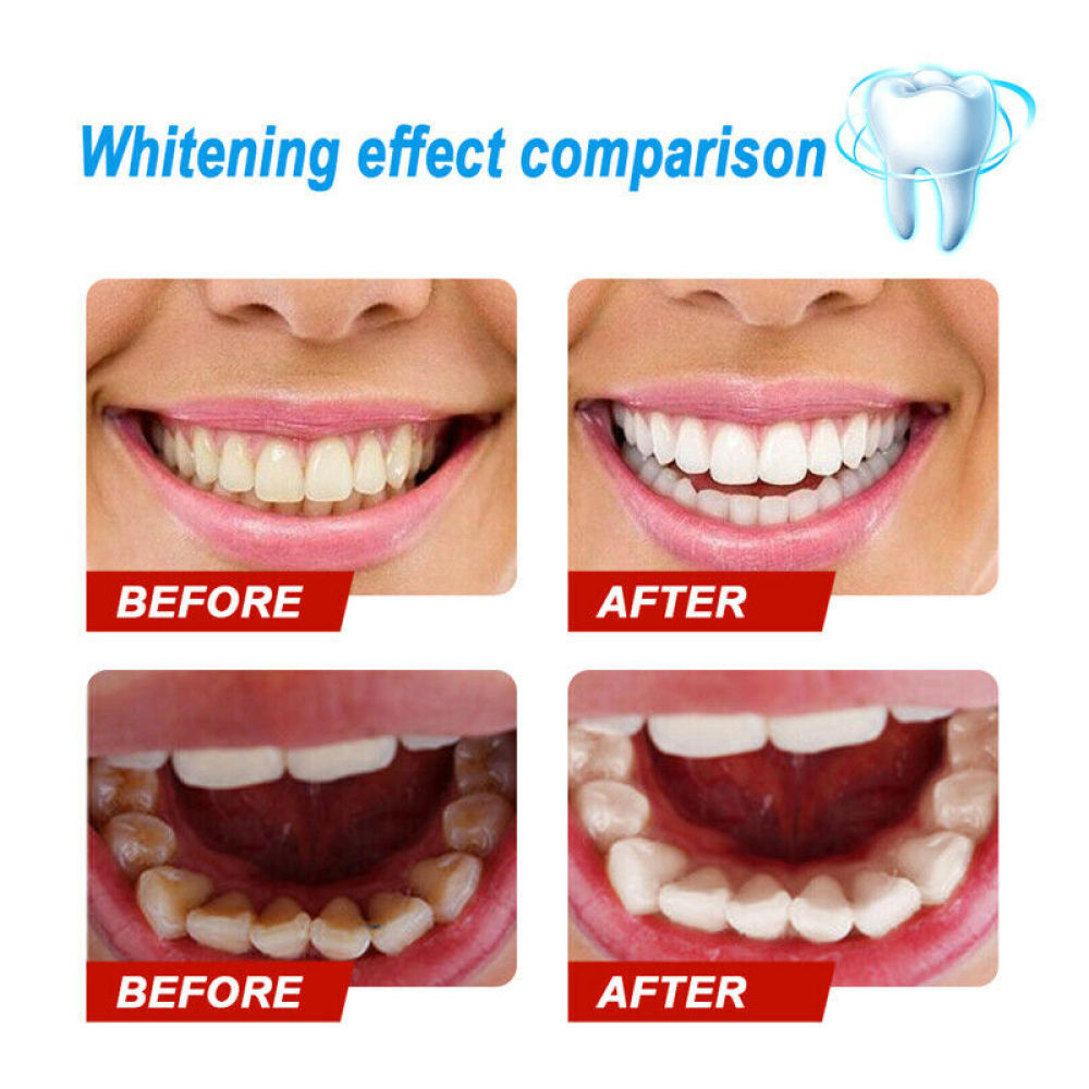 Teeth Whitening Serum Gel Oral Hygiene Teeth Cleaning dental Care Toothpaste