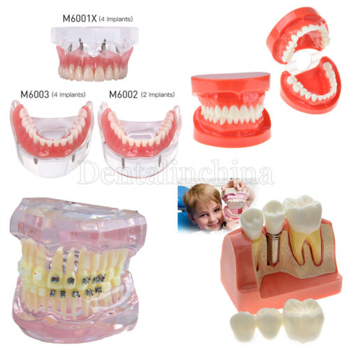  Dental Study Teach Adult Standard Typodont Model Demonstration Teeth 
