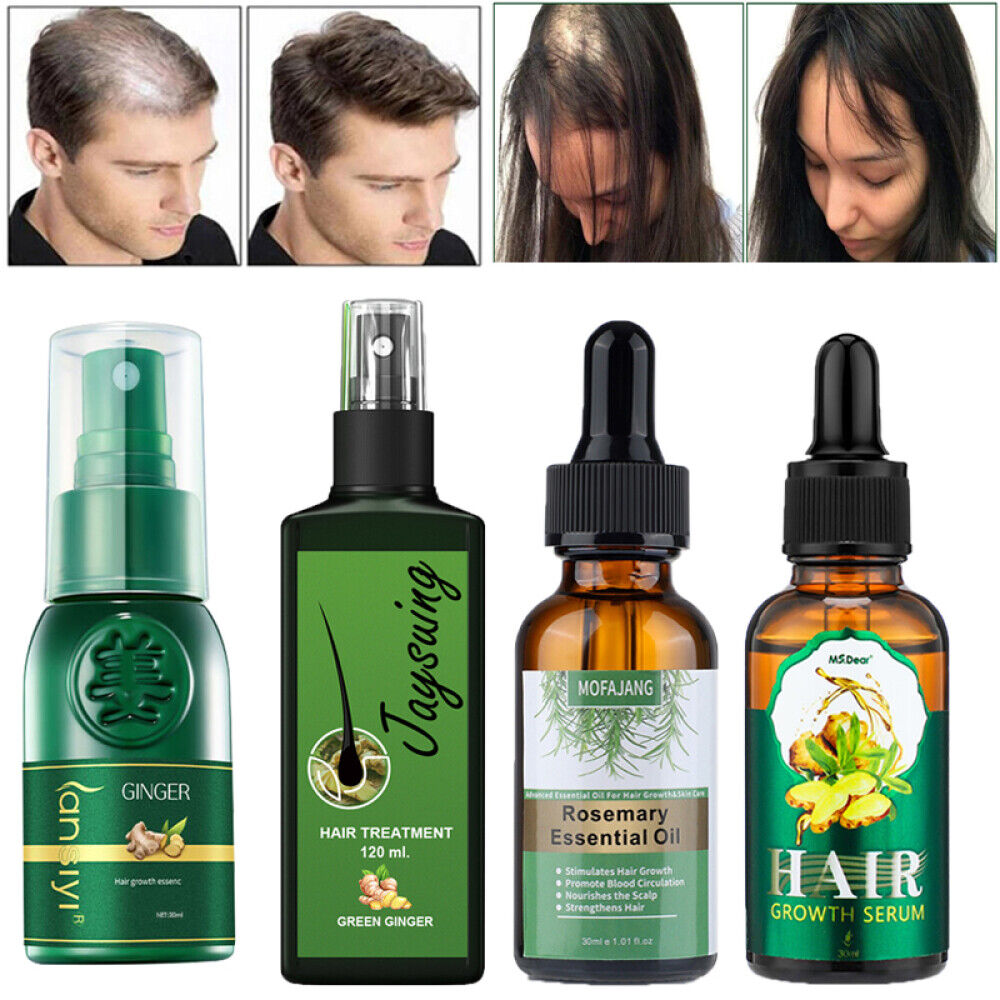 Rosemary Oil, Ginger Hair Growth Serum Spray Cream Prevent Hair Loss & Thinning