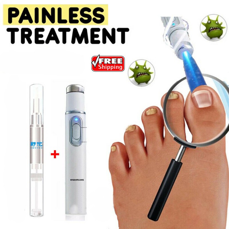 Anti-Pilz Heimbehandlung Zehe Nagelbehandlung Stift für Onychomykose Paronychia