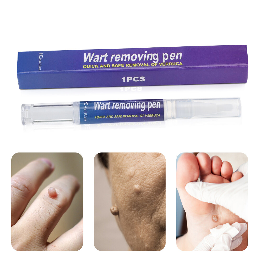 12 Hours Wart Remover Pen Skin Tag Mole Remover Eliminate Foot Corn Warts  Unisex