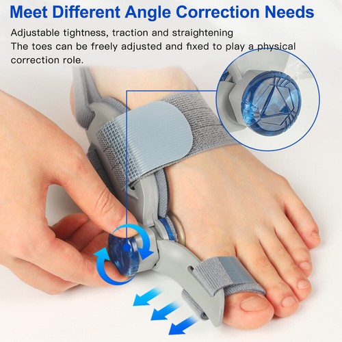 HALLUX TOE BUNION CORRECTOR STRAIGHTENER SUPPORT STRAP ORTHOPEDIC FOR MEN WOMEN 