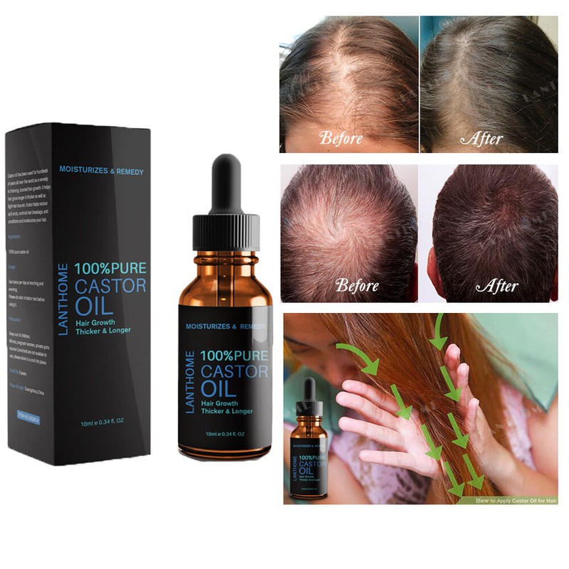 Castor Oil Pilatory Ginger Regrowth Essence Anti Hair Loss Hair