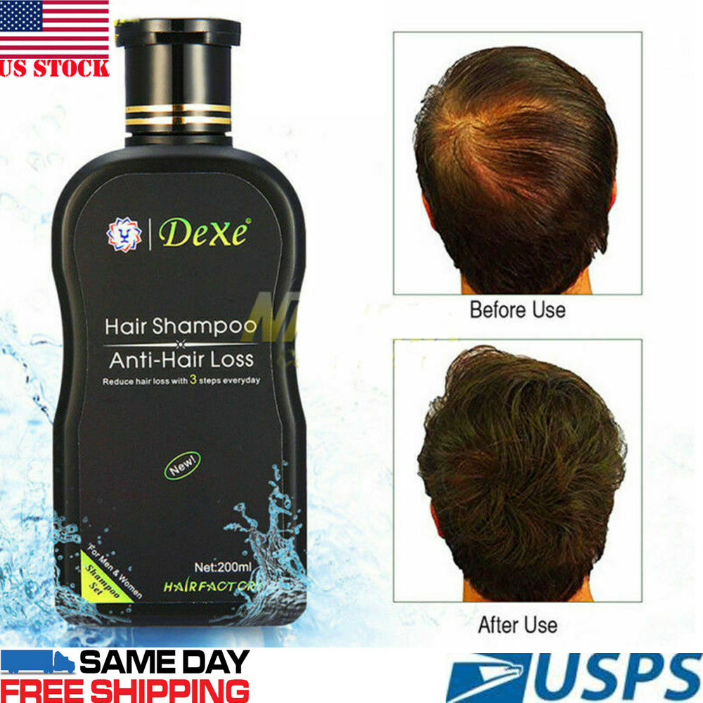 Details about 447ml Dexe Anti hair Loss Shampoo❤447ml 47 Days Fast Hair  Regrowth Oil for Unisex