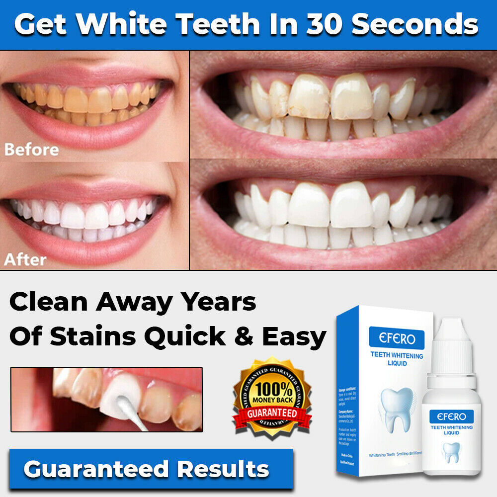 NEW INSTANT TOOTH WHITENING KIT WHITE TEETH CLEAN GEL UV