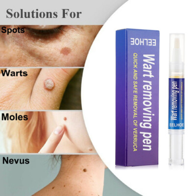 Fast Skin Tag Mole Wart Remover Liquid WipeOff Tags & Moles Removal Pen Organic