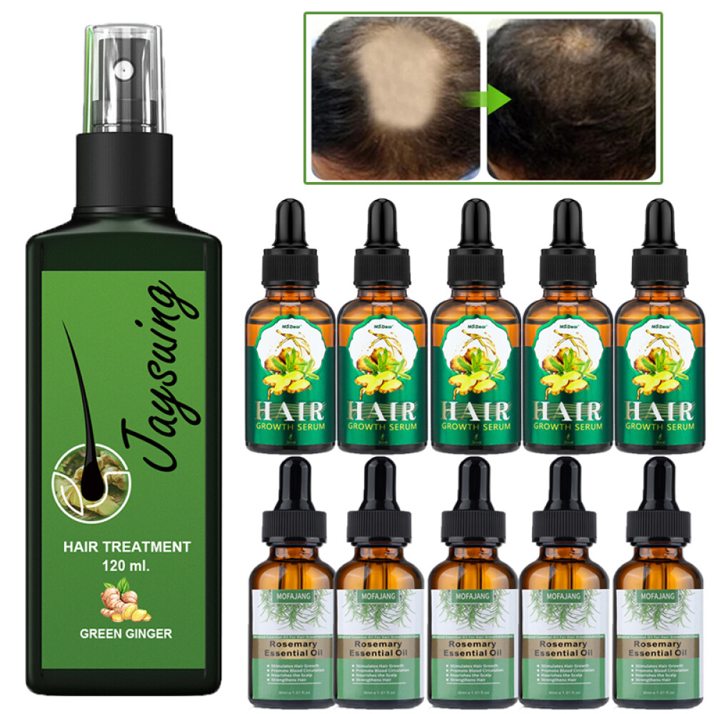 For Hair Growth, Ginger Hair Regrowth Serum Spray Cream