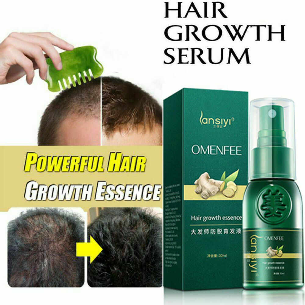 MIMIMACHI Haarwuchs-Serum 2x20 Ml – Mit Ingwer & Ginseng Gegen Haarausfall, Für Alle Haartypen