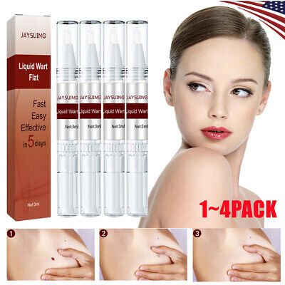 1-4X Painless Wart Remover Pen Eliminate Skin Tag Foot Corn Mole Warts Restorat.