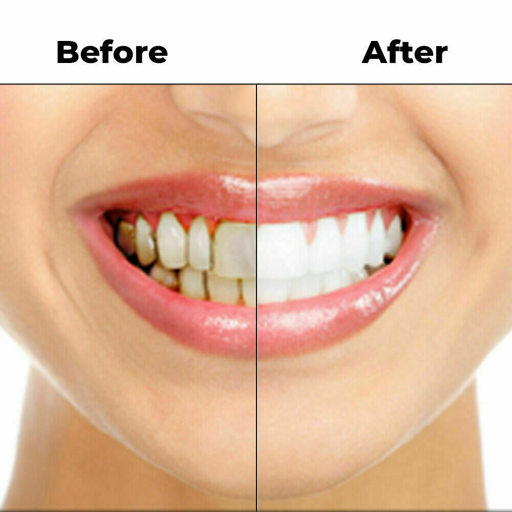 Teeth Cleaning gel EFERO Whitening Essence Serum Oral Hygiene dental Care Serum