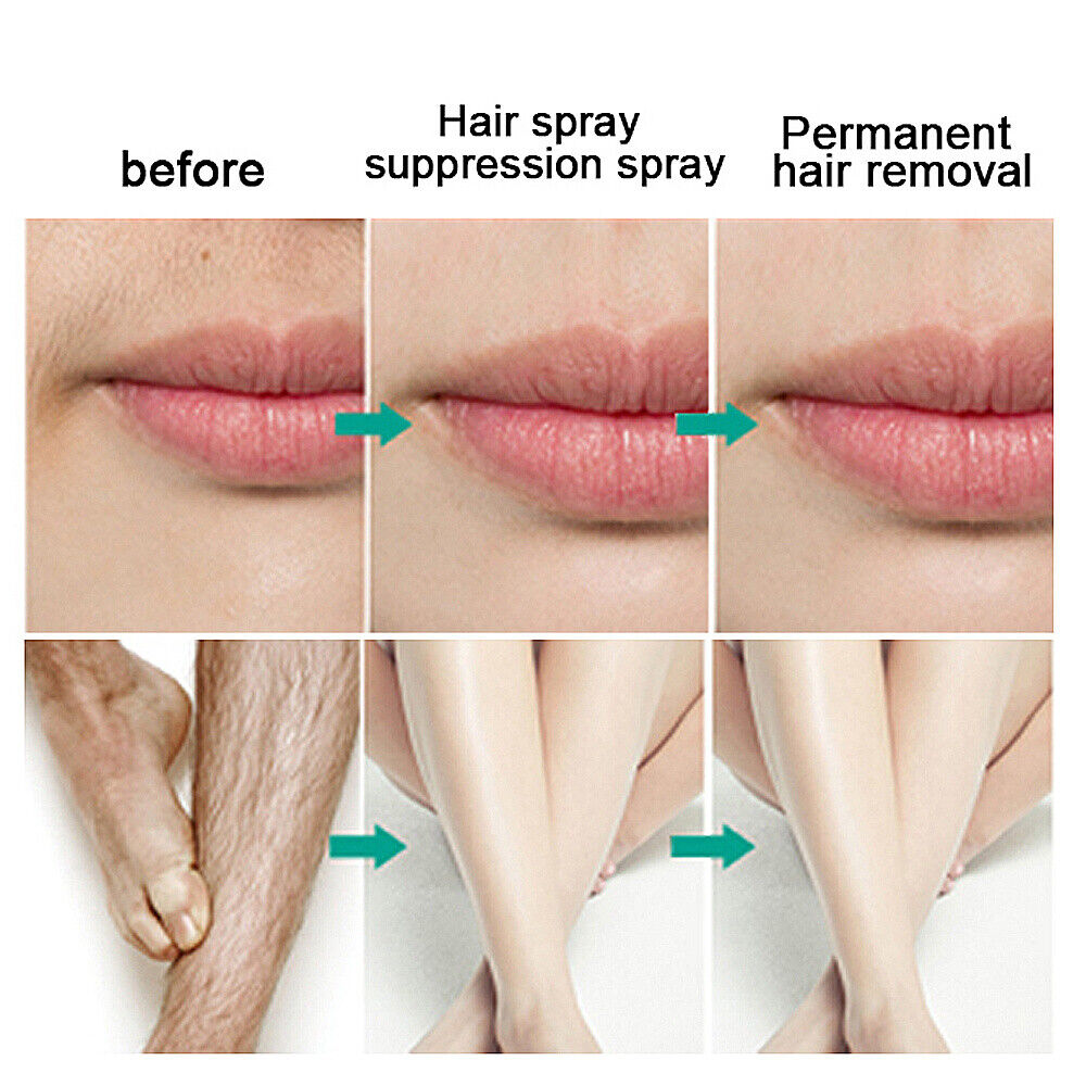 Facial Hair Spray Permanent Stop Hair Growth Inhibitor Pubic Hair