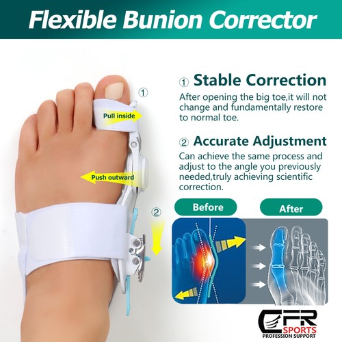 CFR Hallux Valgus Pain Support Big Toe Orthopedic Bunion Straightener Corrector