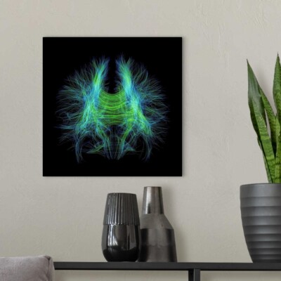 Brain fibres, DTI MRI scan Canvas Wall Art Print,  Home Decor
