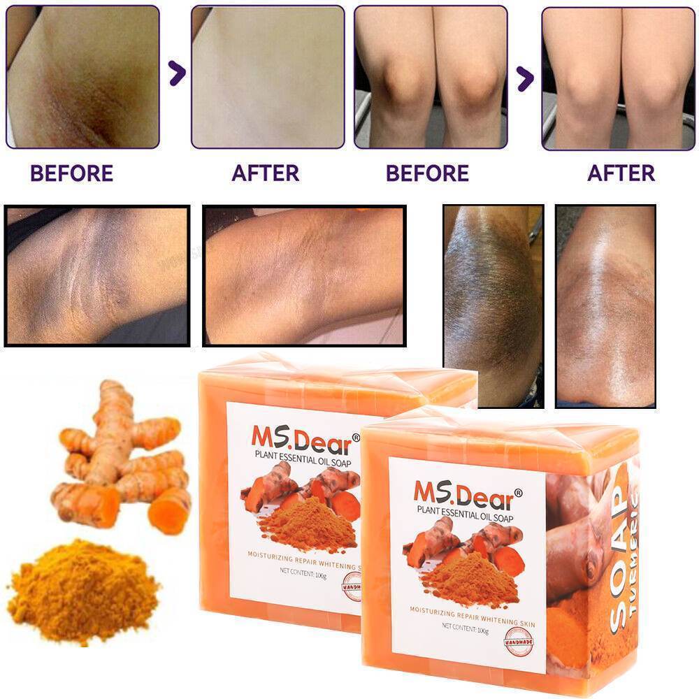 2× Turmeric Soap Skin Whitening Dark Spots lightening Acne Brightening Turmeric
