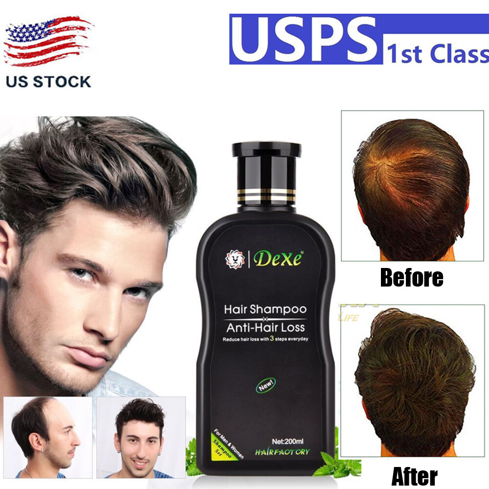 Dexe Black Hair Shampoo Hair Color Anti Hair Loss Shampoo Fast Hair Growth 200ml Ebay