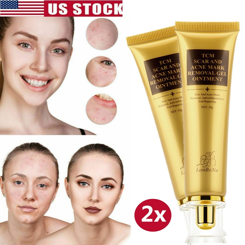 ointment for pimple marks