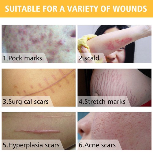 wound spot removal cream