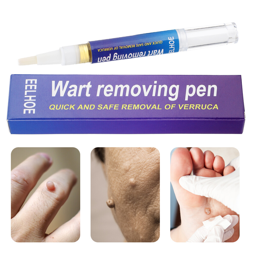 2× Wart Remover Pen Eliminate Skin Tag Foot Corn Mole Warts Restoration Painless