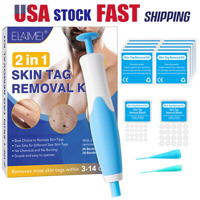 US Auto Micro Skin Tag Remover Device Kit Safe Painless Removal  Mole Wart 2-8mm