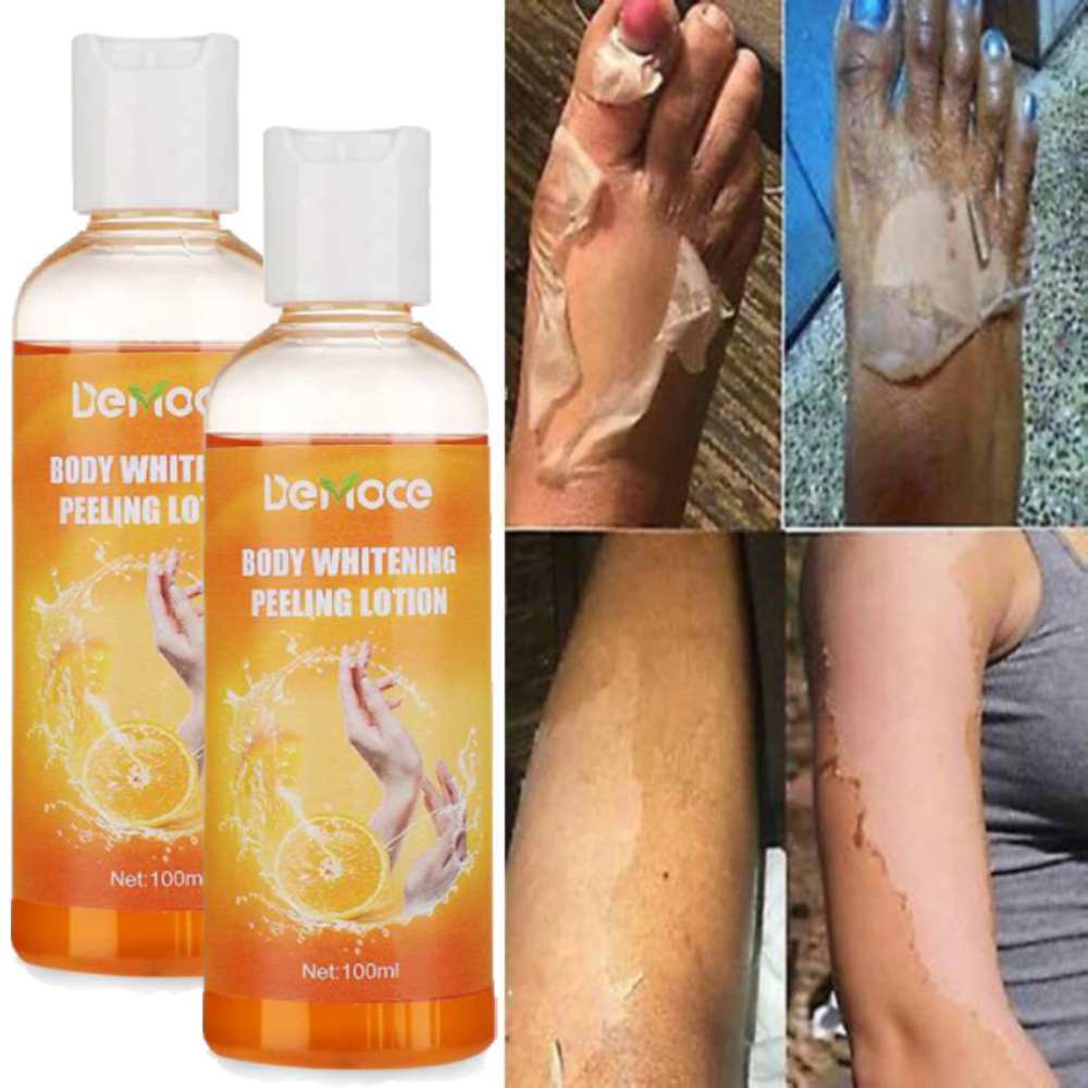 Bleaching Whitening Dark Skin Remove Dark Knuckles