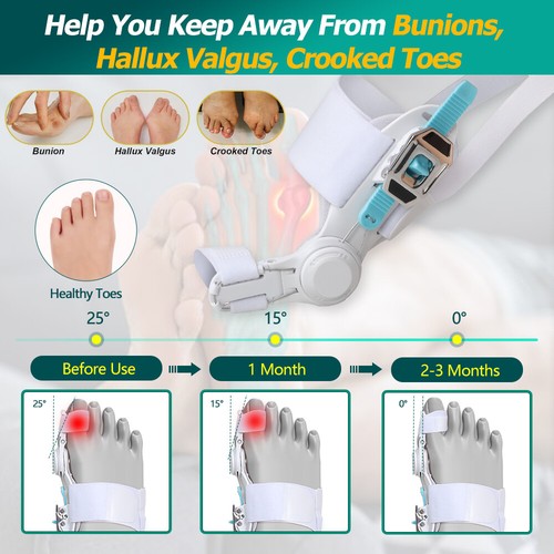 CFR Hallux Valgus Pain Support Big Toe Orthopedic Bunion Straightener Corrector