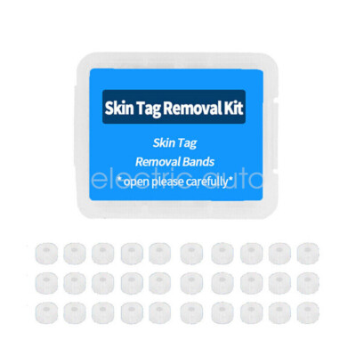 2 in1 Painless Auto Skin Tag Mole Wart Removal / 40x Rubber Band Alcohol Pads US