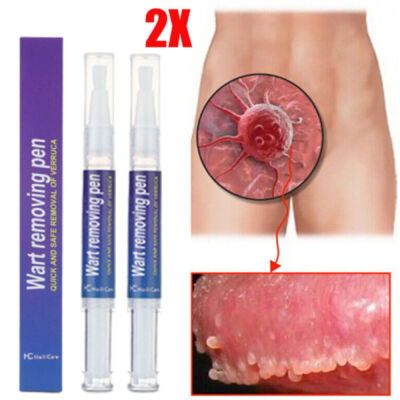 2PACK 12 Hours Wart Remover Pen Skin Tag Mole Remover Eliminate Foot Corn Warts