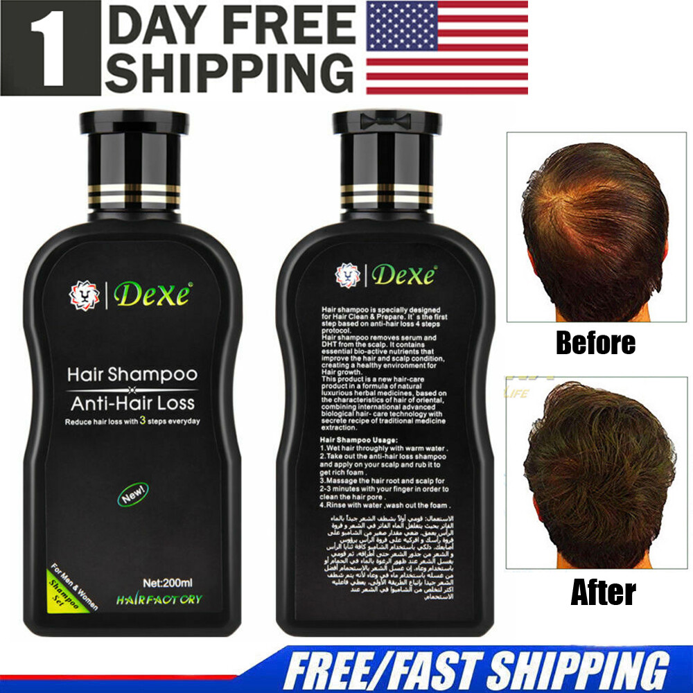 200ml Dexe Hair Shampoo Anti Hair Loss Chinese Herbal Hair Growth