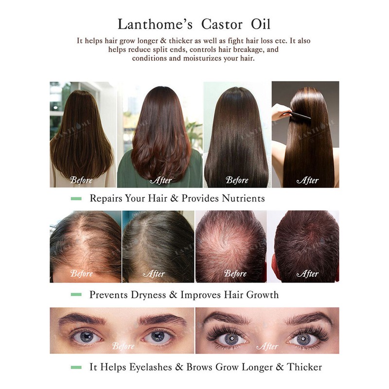 Details Zu Castor Oil Ginger Regrowth Essence Pilatory Hair Growth Serum Anti Hair Loss